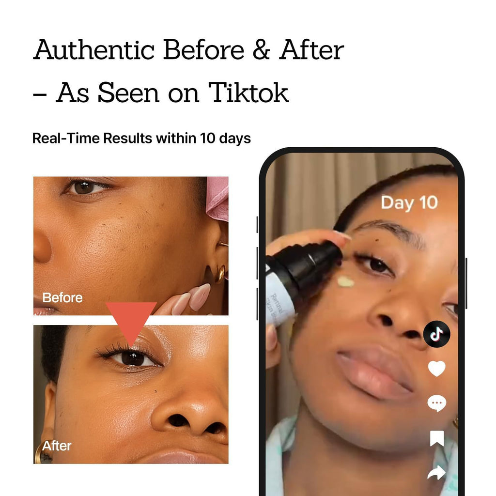 Retinol Serum